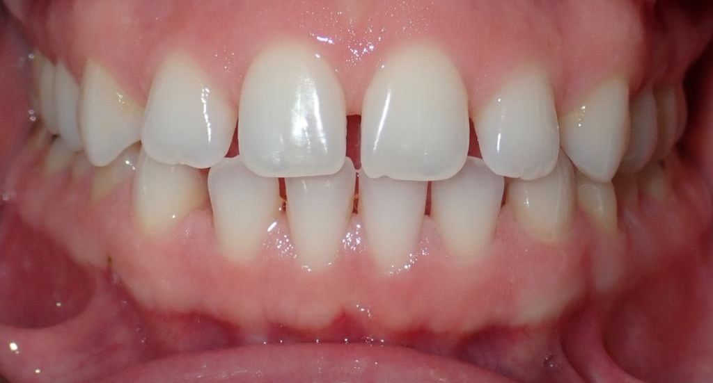 Patient-2-before-3 (2)